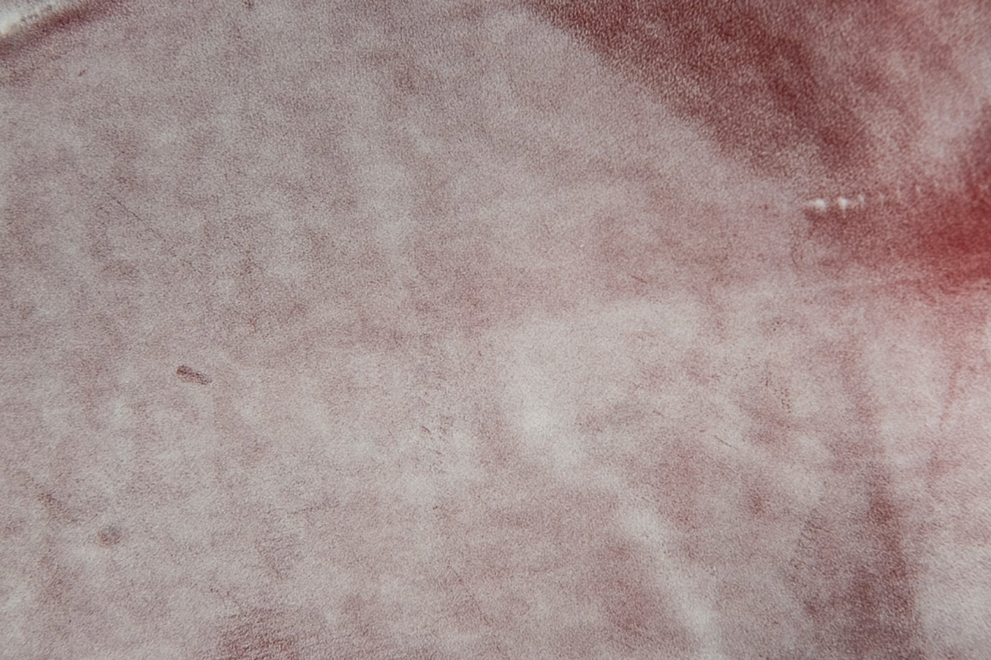 Pacemaker MKIV